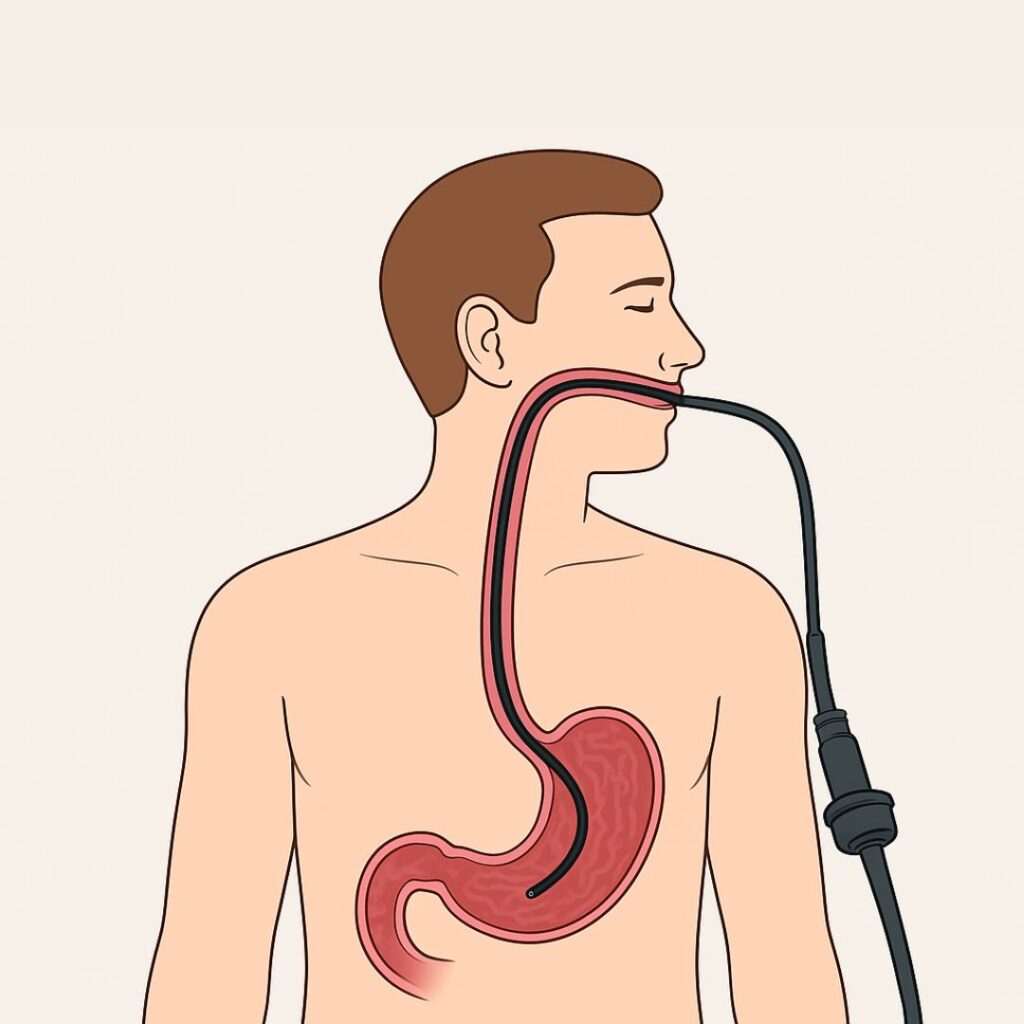 आहार नली एवं पेट की जाँच (upper gi)