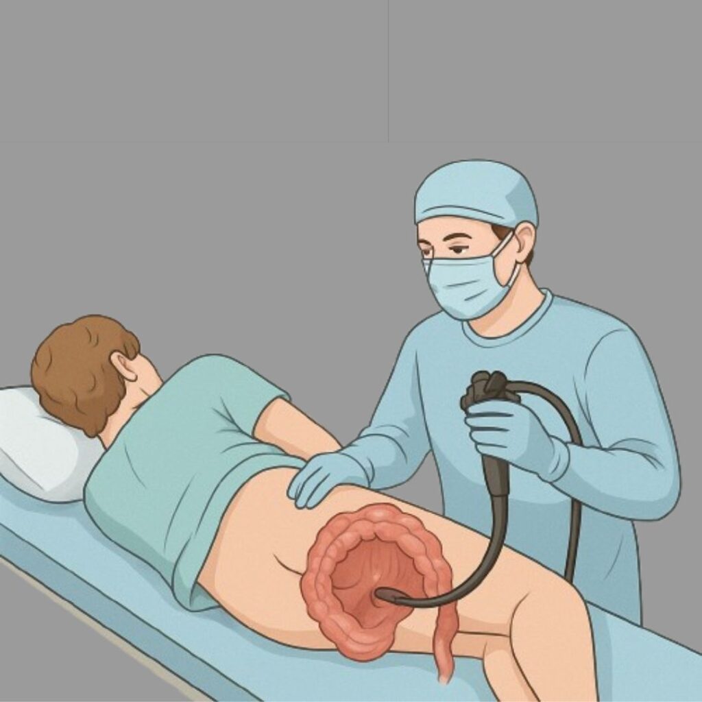 बड़ी आंत की मल द्वार द्वारा रेक्टम की जांच (colonoscopy)