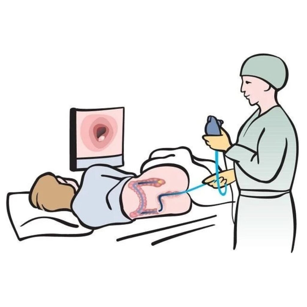 एंडोस्कोपी द्वारा फॉरेन बॉडी निकालना (Foreign Body Removal)